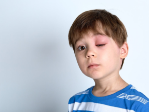 What to do to stop children from visiting a Sydney eye clinic