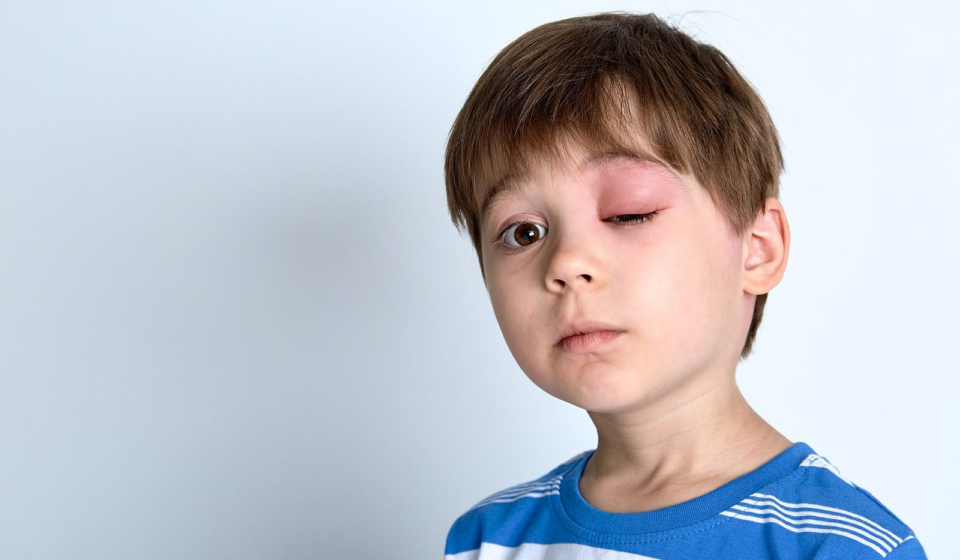 What to do to stop children from visiting a Sydney eye clinic