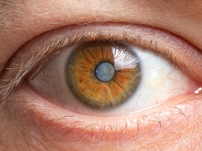 cataract cost