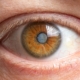 cataract cost